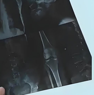 KRLFb 柯丽尔医用激光胶片