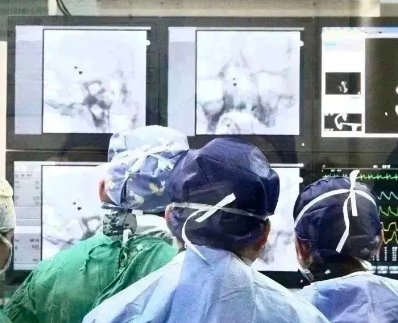 血流导向密网支架微创神通