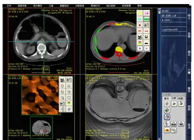 uAI-AbdomenImaging-MRI 腹部磁共振影像处理软件