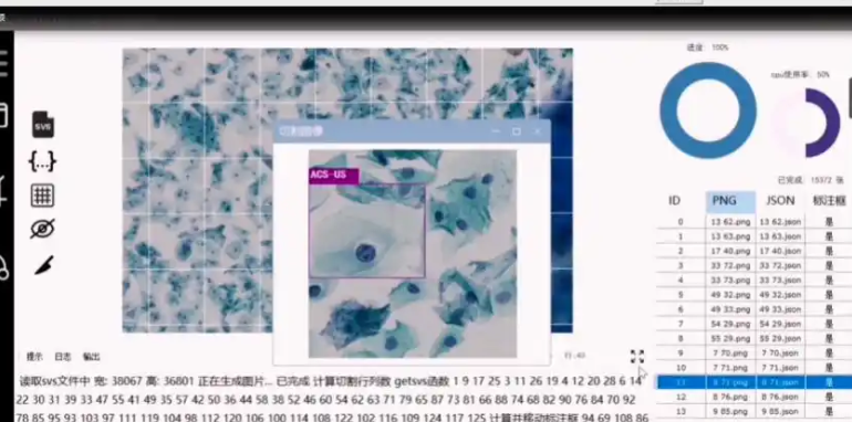 Autoscope TCT 宫颈细胞影像筛查处理软件
