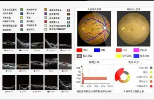 FACT-EYE1.0 眼科影像管理系统