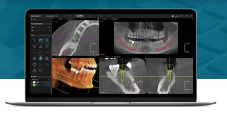 DTX StudioTM Clinic 数字化牙科影像处理软件