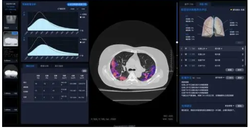 uOmnispace.CT CT医学影像处理软件