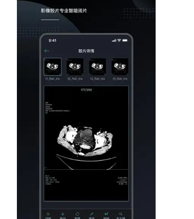 AnnetCloudFilm 电子云胶片及报告系统软件