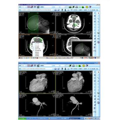 PACS医学影像信息系统软件iHospital-PACS博为