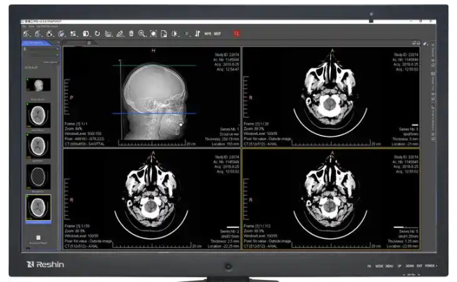 BrainActive 磁共振影像处理软件