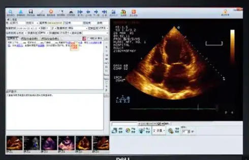 SonoStation 超声影像工作站软件