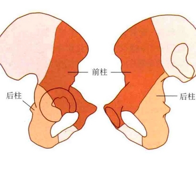 微创生物型髋臼系统