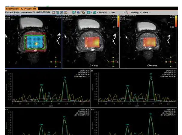 HY-MRI-PIRADS 前列腺MRI医学影像存储传输与处理软件
