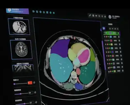 HY-MRI-CRADS 直肠MRI医学影像存储传输与处理软件