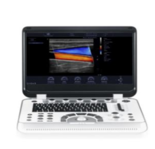 finus 70exp 便携式彩色多普勒超声诊断系统