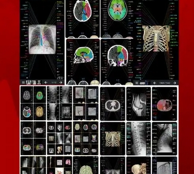 医学影像存储与传输系统软件