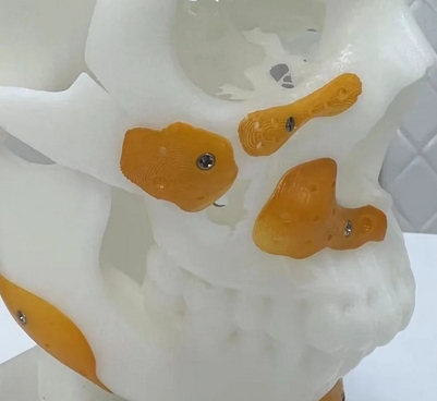 PALACOS LG骨水泥乐铠生物厂家