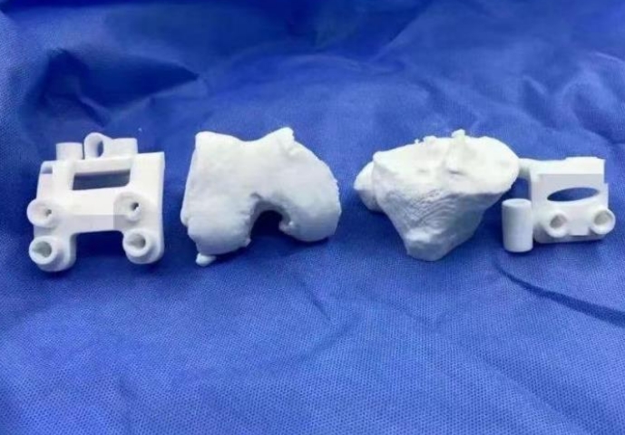 CNPSI0002R 骨科截骨手术3D打印导板价格区间