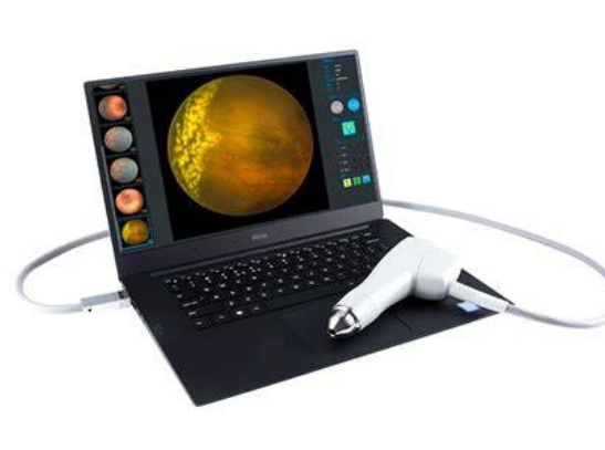 SW-8000P 眼科广域成像系统代理