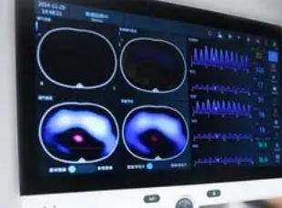 EIT600-M 胸阻抗断层成像仪总代理