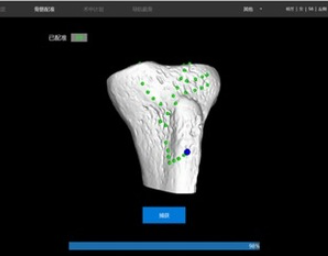 WeiZ-01 全膝关节置换手术导航定位系统厂家直销