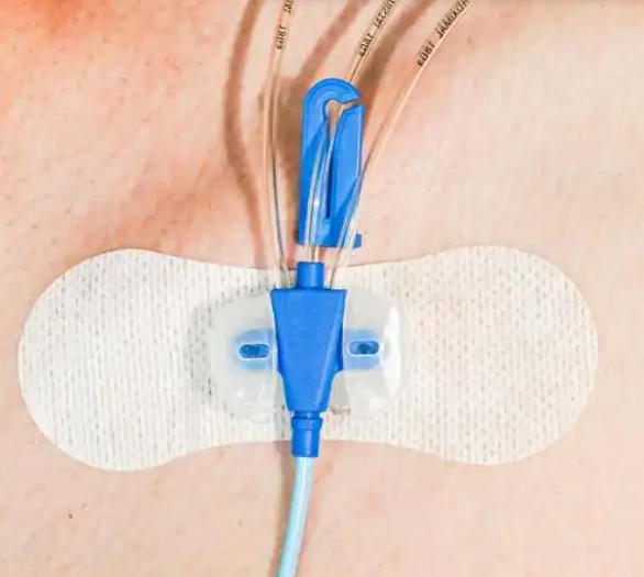 导管固定敷贴厂家