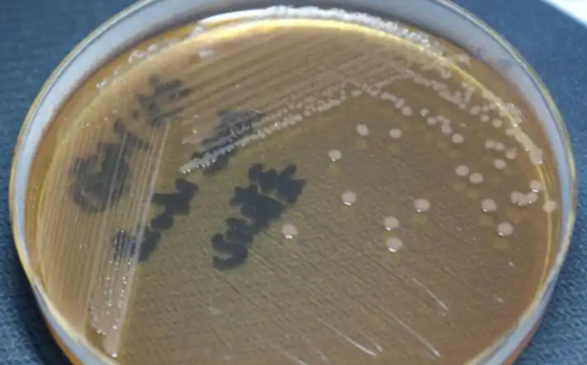 一次性麦康凯琼脂培养基厂家