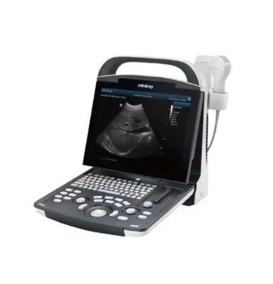 Resona R9 Ruby超声诊断系统询价
