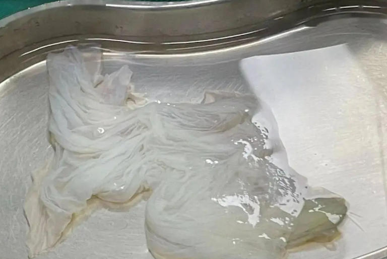 湿态生物羊膜厂家