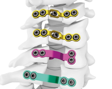 椎板固定板系统总代理