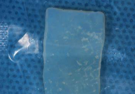 KX-01 脱细胞异体真皮口腔组织补片厂家销售价