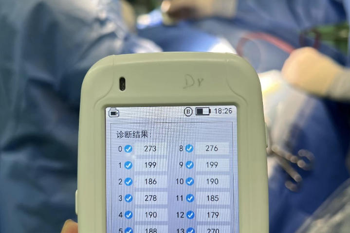 SCR303A 脊髓刺激医生程控充电器 厂家