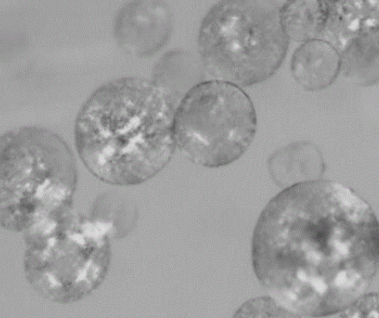 聚乙烯醇栓塞微球恒瑞迦俐生哪个品牌好？