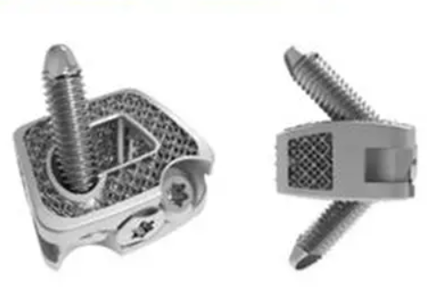 自稳定型颈椎融合器询价