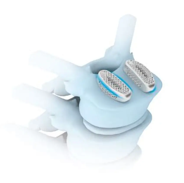 自稳定型颈椎融合器哪个品牌好？