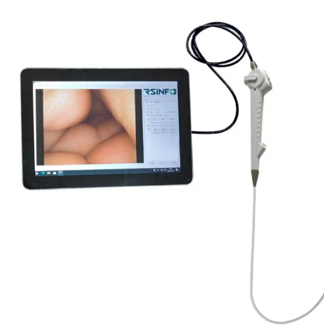 TVS-BRS-III电子支气管内窥镜代理