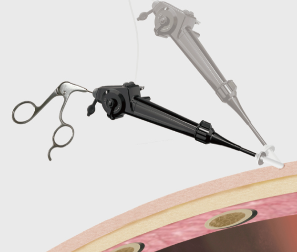 FET-680T2电子胸腔内窥镜直销价