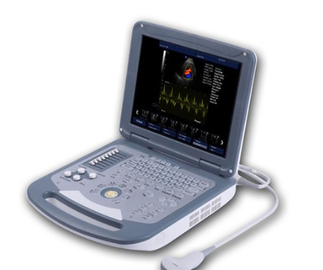 HY-U7笔记本彩色多普勒超声诊断仪厂家