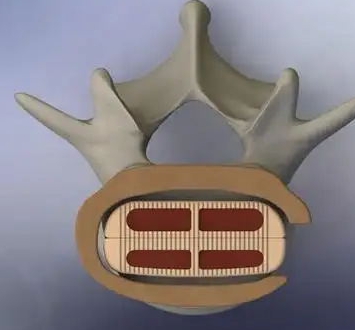 11.png
