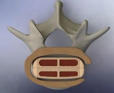 11.png