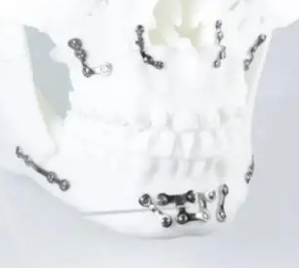 11.png