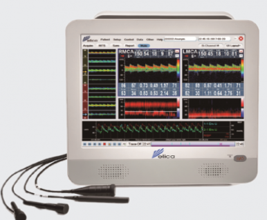 3D1 超声经颅多普勒血流分析仪价格范围