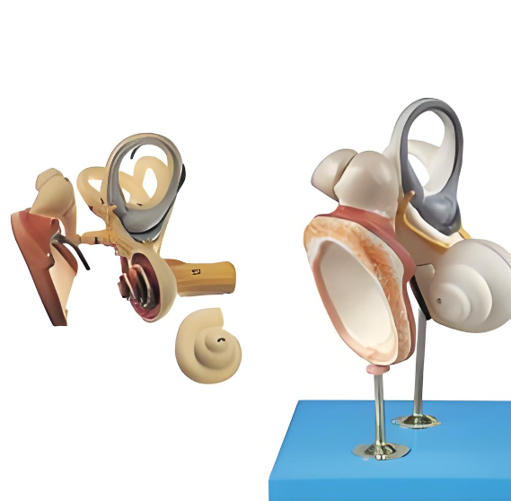 德国进口 听小骨假体 Middle ear implants 代理