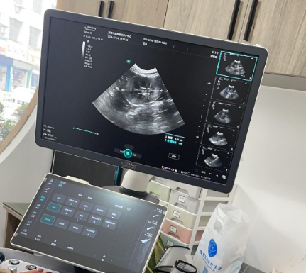  诊所专用 DP-18 超声整机货源