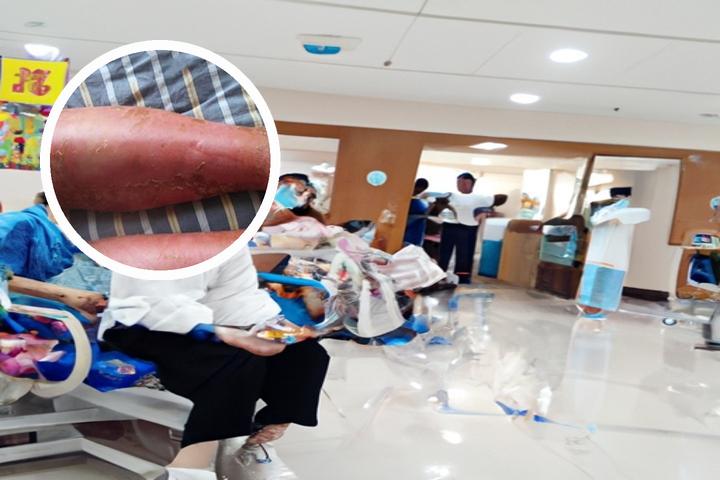 tdp治疗仪怎么用tdp和红外线理疗仪有什么区别